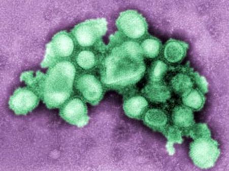 பன்றிக் காய்ச்சல் குறித்து கவலை வேண்டாம்- தடுப்பு நடவடிக்கைகளுடன் தயார் நிலையில் தமிழக அரசு