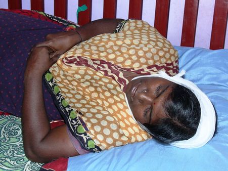 பஸ் கைப்பிடி கழன்று விழுந்து பெண் படுகாயம்...!