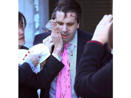 தெ. கொரியாவுக்கான அமெரிக்க தூதருக்கு பிளேடு வெட்டு.... கொரியாக்களை இணைக்கக் கோரி முதியவர் தாக்குதல்!