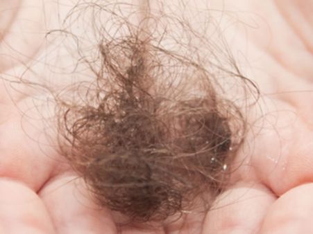 தலைமுடியை நூடுல்ஸ் ஆக சாப்பிட்ட 4 வயது சிறுவன்…: 4 அடி நீள முடி 4 ஆம் தேதி அகற்றம்!