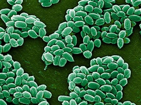 அமெரிக்க ராணுவம் அனுப்பிய உயிருள்ள ஆந்த்ராக்ஸ்… 9 ஆய்வுக்கூடங்களில் பரவிய பீதி