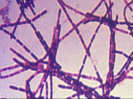 51 ஆய்வுக் கூடங்களில் ஊடுருவிய உயிர்க்கொல்லி ஆந்த்ராக்ஸ்: பெண்டகன் அதிர்ச்சி தகவல்