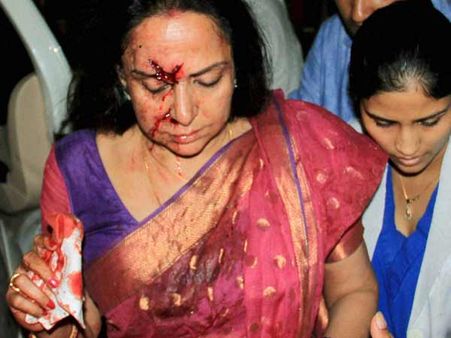 விபத்தினால் மூக்கு எலும்பில் அறுவைசிகிச்சை - இன்று காலை வீடு திரும்பிய ஹேமமாலினி!