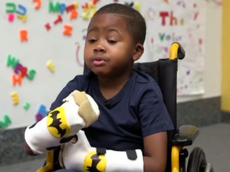 தொற்றுநோயால் பறி போன 2 கைகளுக்கும் மாற்றாக புதிய கைகள் பொருத்தப்பட்ட அமெரிக்க சிறுவன்