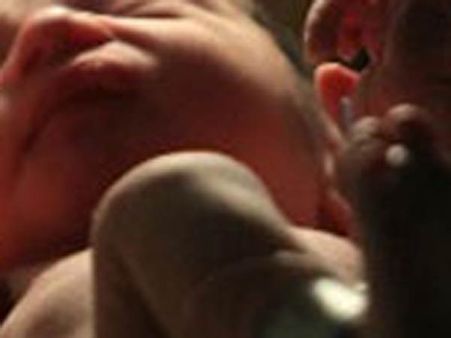 தாயின் கருவில் குண்டடிபட்ட பெண் குழந்தை உயிர் பிழைத்த அதிசயம்