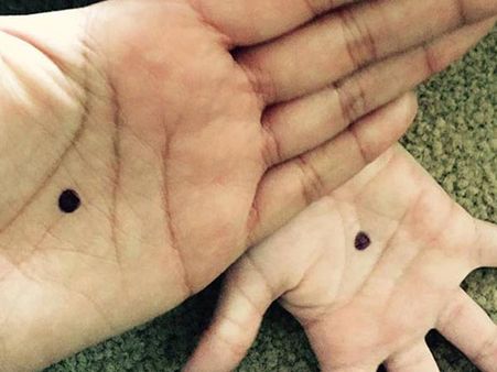 குடும்ப வன்முறையால் பாதிப்பா? - கைகளில் “கருப்புப் புள்ளி” வைங்க பெண்களே!