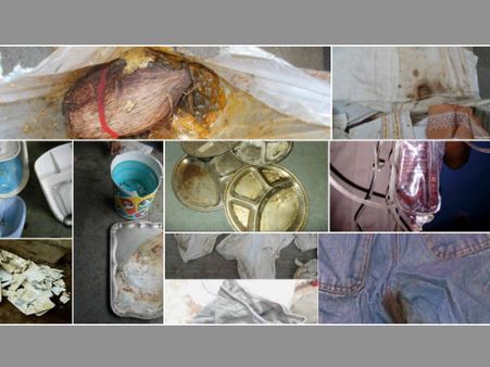 மடிந்துபோன மனிதநேயம்.. கெட்டுப்போன சாப்பாடு, ரத்த கறை படிந்த ஆடைகள் தானம்! தொண்டு நிறுவனம் கொதிப்பு