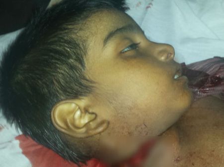 சென்னையில் காற்றாடியின் மாஞ்சா நூல் அறுத்து 5 வயது சிறுவன் பலி