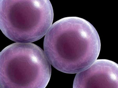 ”ஸ்டெம் செல்” மூலமாக கண் பார்வை மீட்கும் சிகிச்சை - லண்டன் டாக்டர்களின் புதிய முயற்சி