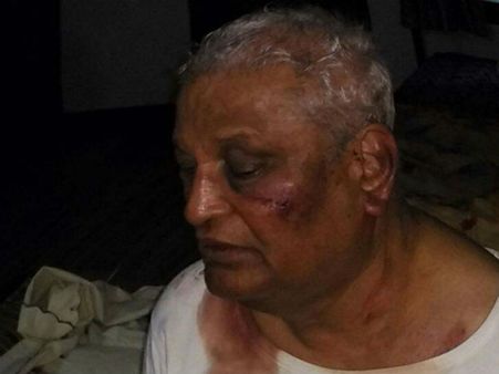 ஜெயலலிதா வழக்கை விசாரித்த ஓய்வுபெற்ற நீதிபதி மீது மர்ம நபர்கள் கொலைவெறி தாக்குதல்!