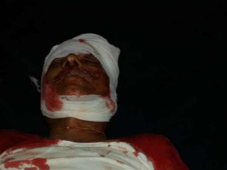 கர்நாடகாவில் திப்பு ஜெயந்தி விழாவில் பயங்கர மோதல்.... வி.ஹெச்.பி. நிர்வாகி உயிரிழப்பால் பதற்றம்!