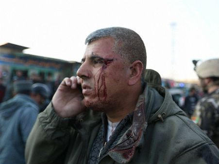 காபூல் விமானம் நிலையம் அருகே தலிபான்கள் பயங்கர தற்கொலைப்படை தாக்குதல்- ஒருவர் பலி; 13 பேர் படுகாயம்