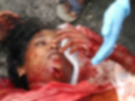 கல்லூரி மாணவியை சரமாரியாக வெட்டிய காதலர்.. மரத்தில் தூக்கிட்டுத் தற்கொலை