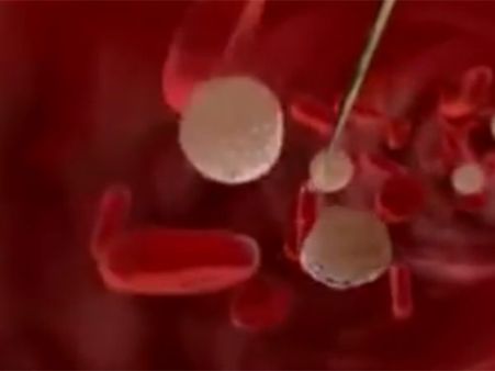 ஜிக்கா பாதிப்புள்ள நாடுகளில் பெண்கள் கருக்கலைப்பு செய்ய அனுமதிக்க வேண்டும்: ஐ.நா.