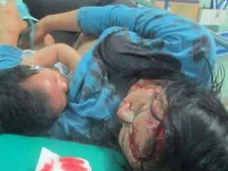 உடலெங்கும் ரத்தம் வழிய மகனுக்கு பாலூட்டிய தாய்... நெஞ்சை உருக்கும் போட்டோ!