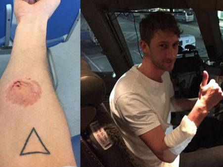 விமானம் நடுவானில் பறக்கையில் பயணியை நறுக்கென்று கடித்த கோபக்கார சக பயணி