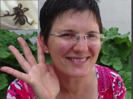 பெண்ணின் காதுக்குள் குடியேறிய சிலந்தி... ஆபரேசன் மூலம் நீக்கம்