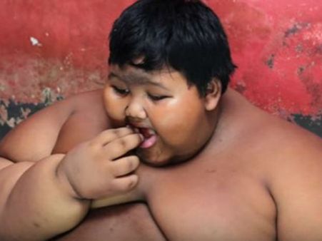 இந்தோனேஷியா: 10 வயதில் 192 கிலோ எடை... உலகத்தின் பருமனான சிறுவன் இவர்தான்