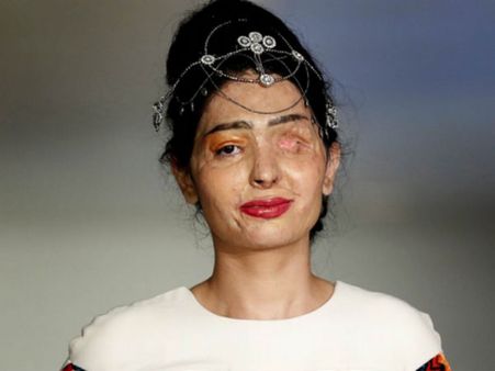 ஆசிட் வீச்சில் மீண்ட இந்தியப் பெண் அமெரிக்க ஃபேஷன் ஷோவில் அசத்தல்