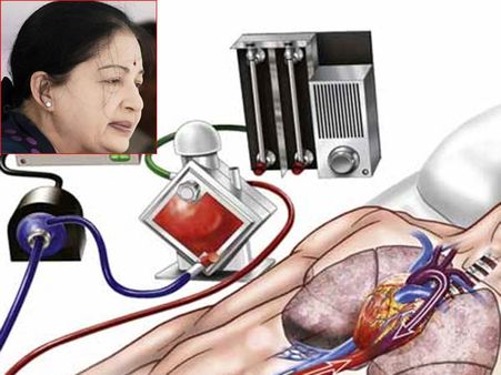 ஜெ. கதை முடிஞ்சதே...எக்மோவை கழற்றி வீசுங்க.. உத்தரவிட்ட 