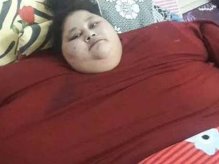 இரண்டே மாதத்தில் 250 கிலோ எடை குறைத்த குண்டு பெண், ஆனால் இனிமேல்...