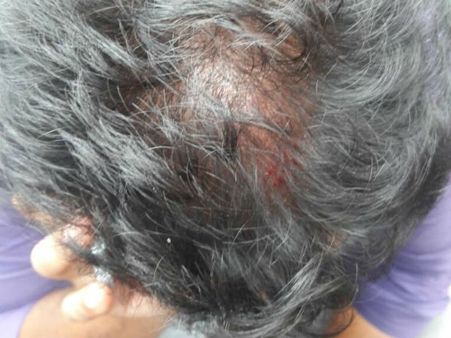 தீபா திடீர் வருகை.. ரணகளமானது போயஸ் கார்டன்... பத்திரிகையாளர்கள் மீது கொடூரத் தாக்குதல்