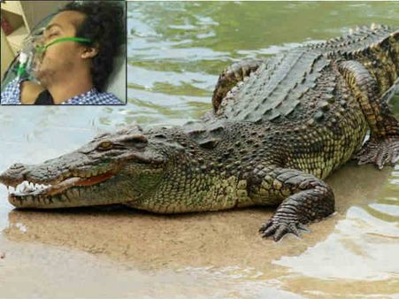 இளம் தொழில்முனைவர் கையை குதறிய 'முதலை'... அதிர்ஷ்டவசமாக உயிர்பிழைத்தார்!