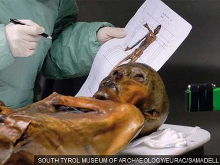 100 அடி உயரம்.. முதுகைத் துளைத்த அம்பு.. 5300 ஆண்டுகளுக்கு முன்பு நடந்த ஒரு படுகொலை!