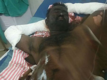 கொடுங்கையூர் பேக்கரி விபத்தில் பலி எண்ணிக்கை 5 ஆக உயர்வு