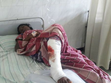 ஆபரேஷன் செய்யும் அளவுக்கு அடித்த ஆசிரியை.. நாகர்கோவிலில் பரபரப்பு!