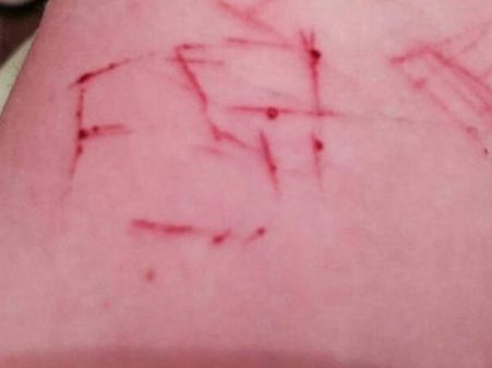 கன்னியாகுமரியில் மாணவர் கையை பிளேடால் கீறிய இளைஞர்... ப்ளூவேல் விபரீதமா?