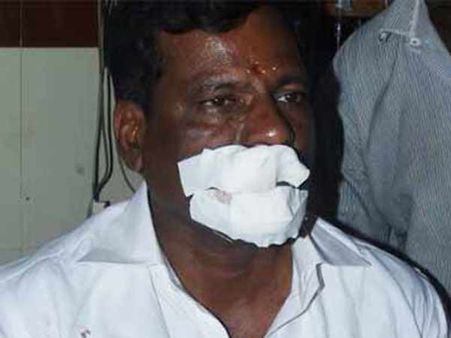 தினகரன் ஆதரவு எம் எல் ஏ ஏழுமலை மீது கொடூர தாக்குதல்.. வாய் கிழிந்தது!