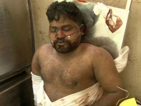 நெல்லை முருகனைத் தொடர்ந்து கேரளாவில் மற்றொரு தமிழருக்கு சிகிச்சை தர மறுப்பு