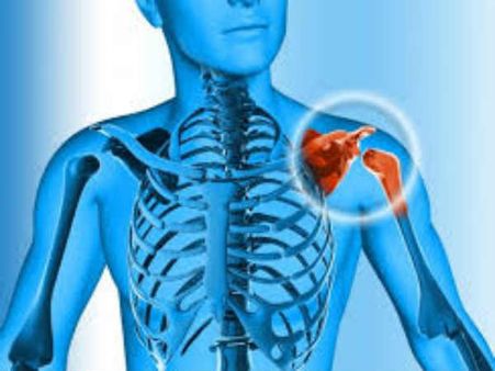 அடிக்கடி எலும்பு முறிவு ஏற்படுகிறதா? ஆஸ்டியோபொரோசிஸ் நோயாக இருக்கலாம்!