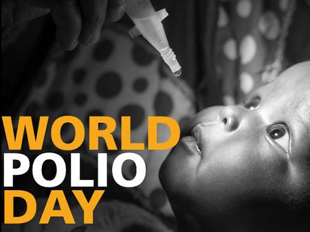 குழந்தைகளுக்கு பாலரிஷ்ட தோஷமிருக்கா? சீக்கிரம் பரிகாரம் பண்ணுங்க # உலக போலியோ தினம்