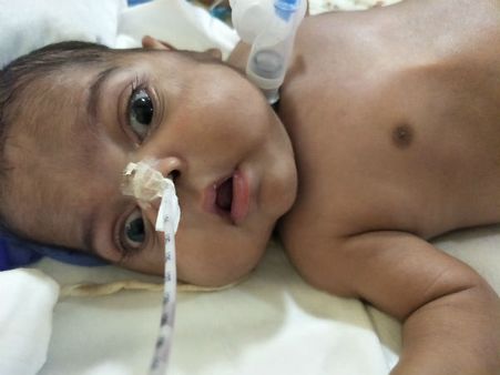 பிறந்ததில் இருந்து ஓராண்டாக ஐசியுவில் இருக்கும் குழந்தையை காப்பாற்ற உதவுங்க ப்ளீஸ்