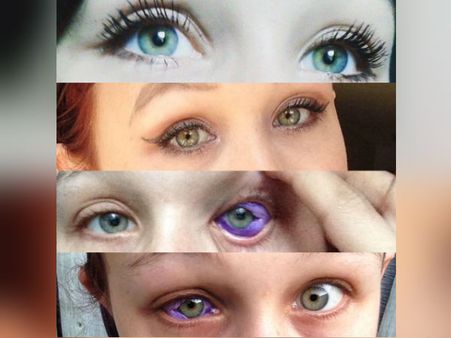 காதலுக்காக கண்களில் பச்சைக் குத்திய பெண்.. காதலும் போச்சு.. கண்ணும் போச்சு