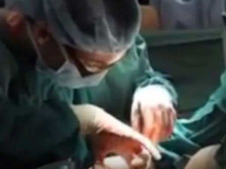 மனிதருக்கு பன்றி சிறுநீரகம்: அமெரிக்க அறுவை சிகிச்சை நிபுணர்கள் சாதனை