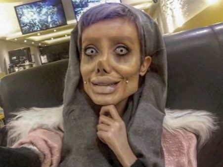 ஏஞ்சலினா ஜோலியாக ஆசைப்பட்டு பிளாஸ்டிக் சர்ஜரி செய்த பெண்.. வாழும் ஏலியனாக மாறினார்