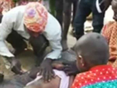 நோய் வராமல் இருக்க சூடு போடும் விநோதம்... ஒடிசாவில் 25 குழந்தைகளுக்கு சித்ரவதை!