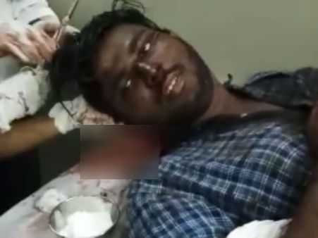 என் உயிருக்கு எதுவும் ஆகாதே...சார் நான் படிக்கணும்... வெட்டுப்பட்ட கல்லூரி மாணவர் உருக்கம்- வீடியோ