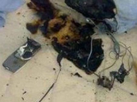 திருப்பூரில் செல்போன் வெடித்து 9ஆம் வகுப்பு மாணவன் காயம்.. பாட்டு கேட்ட போது விபரீதம்