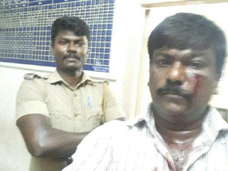 வக்கீலை தாக்கி செல்பி எடுத்த சப்-இன்ஸ்பெக்டர்... ஹைகோர்ட்டு நீதிபதிகள் கண்டனம்!