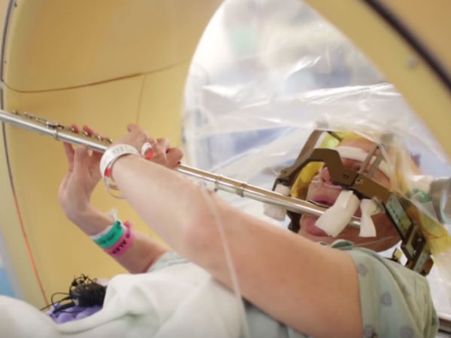 மூளையில் ஆபரேசன்... ஹாயாக புல்லாங்குழல் வாசித்தபடி படுத்திருந்த நோயாளி!