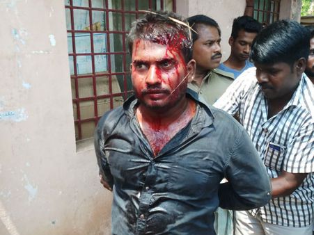 அண்ணாமலை பல்கலை. மாணவி கழுத்தை அறுத்த நவீன் விஷம் குடித்ததால் பரபரப்பு