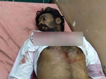 தூத்துக்குடி துப்பாக்கி சூடு: உடல்களை பதப்படுத்தும் பணி தொடங்கியது!