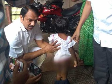 அதிகரிக்கும் அபிராமிகள்: கள்ளக்காதலனுடன் சேர்ந்து 4 வயது குழந்தைக்கு உடல் முழுவதும் சூடு போட்ட தாய்