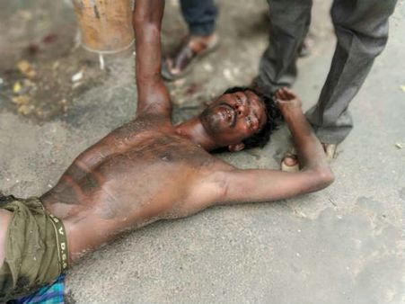 தலையின் உச்சியில் ஏறிய போதை.. போற வர்றவங்களை கடித்த இளைஞர்!