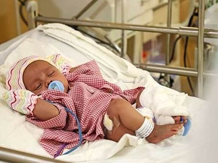 இரத்தக்குழாய் பாதிப்பால் அவதிப்படும் பிஞ்சுக் குழந்தை.. சிகிச்சைக்கு உதவுங்கள்!