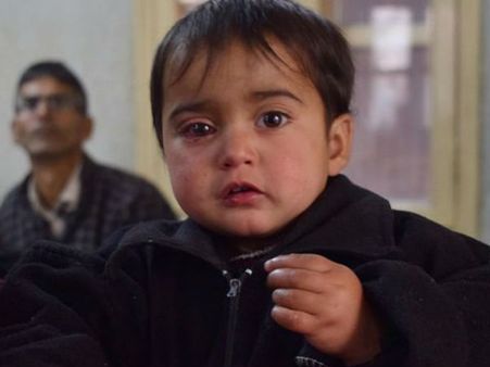 பெல்லட் குண்டால் தாக்கப்பட்ட 1 வயது காஷ்மீர் சிறுமி.. உலகை அசைத்த புகைப்படம்.. குவியும் கண்டனம்!